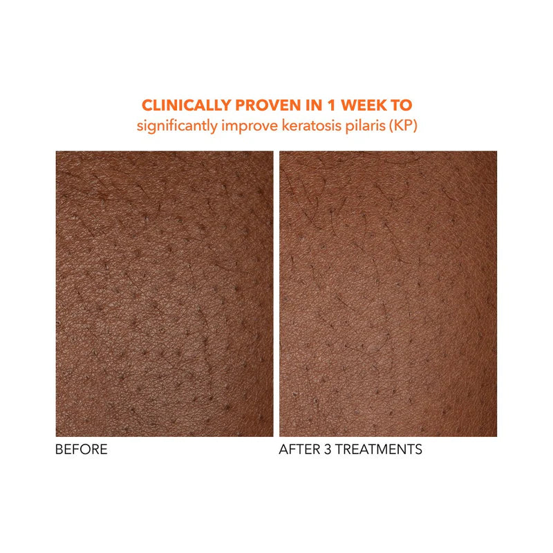Alpha Beta® Exfoliating Body Treatment 8 stk