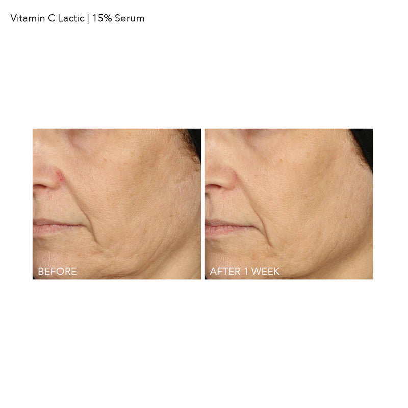 Vitamin C Lactic 15% Firm & Bright Serum