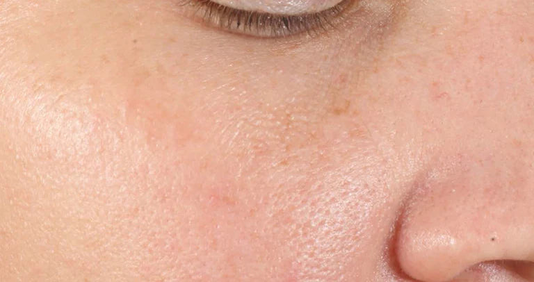 Alpha Beta® Universal Daily Peel 30 stk