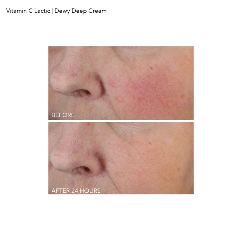 Vitamin C Lactic Dewy Deep Cream
