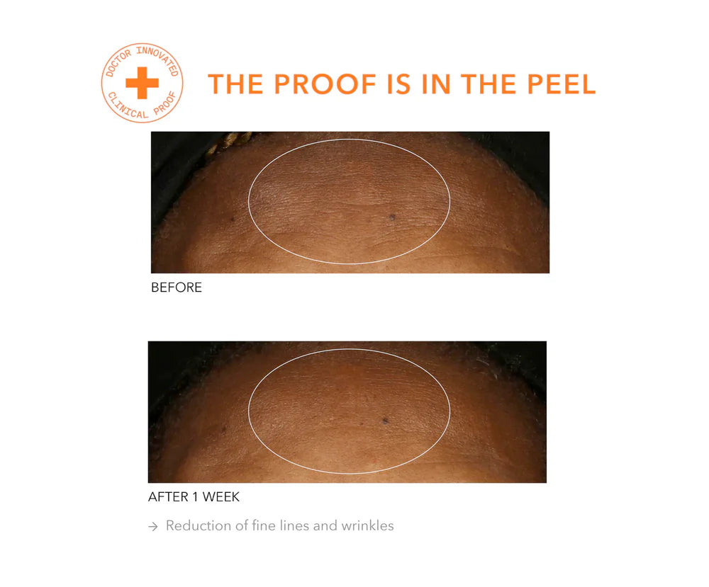 Alpha Beta® Universal Daily Peel 30 stk