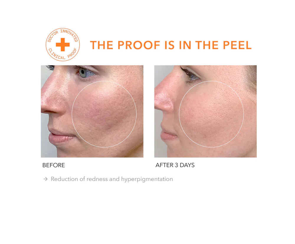 Alpha Beta® Extra Strength Daily Peel 30 stk