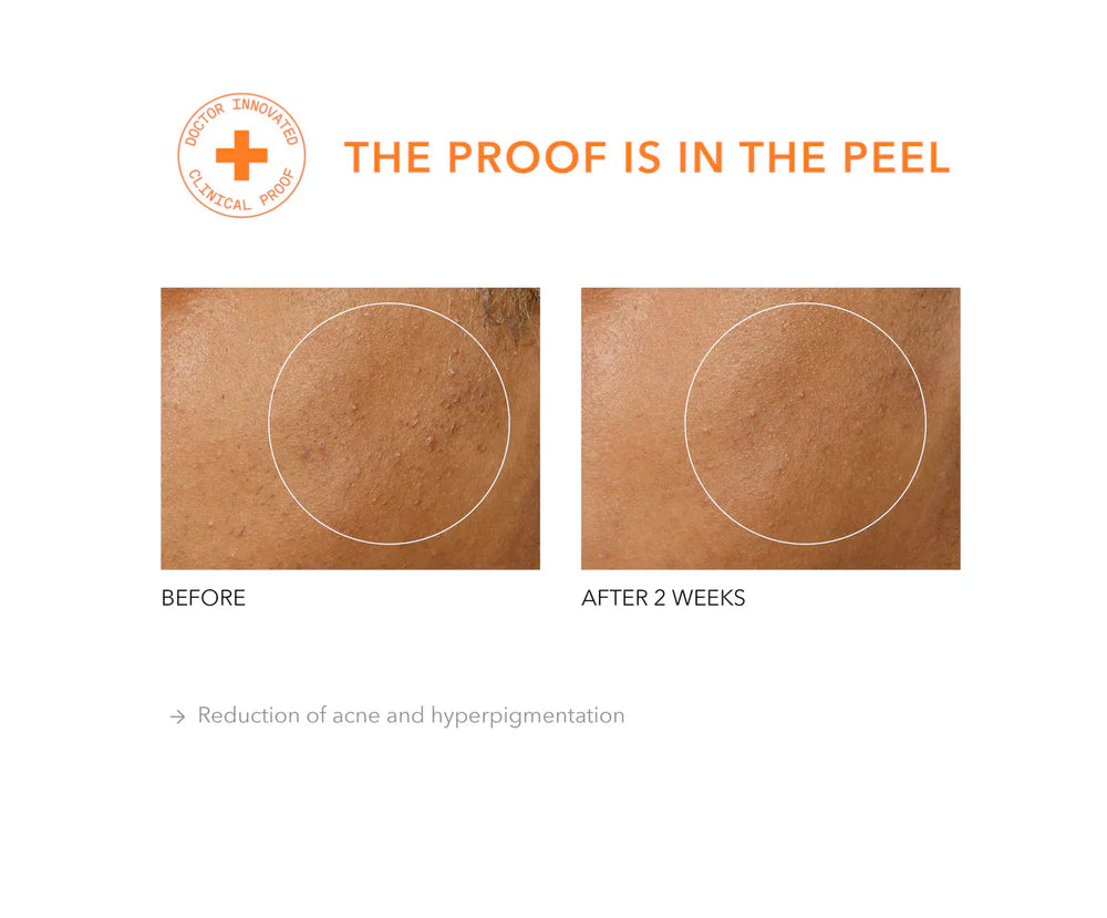 Alpha Beta® Universal Daily Peel 30 stk
