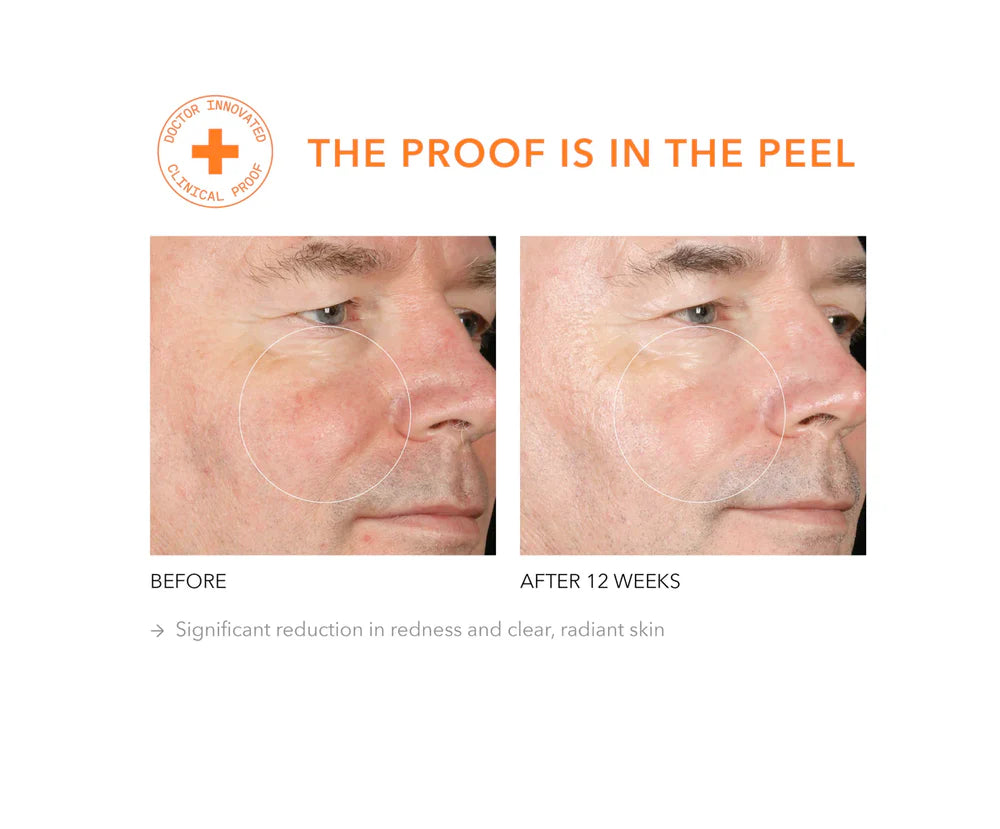 Alpha Beta® Extra Strength Daily Peel 30 stk