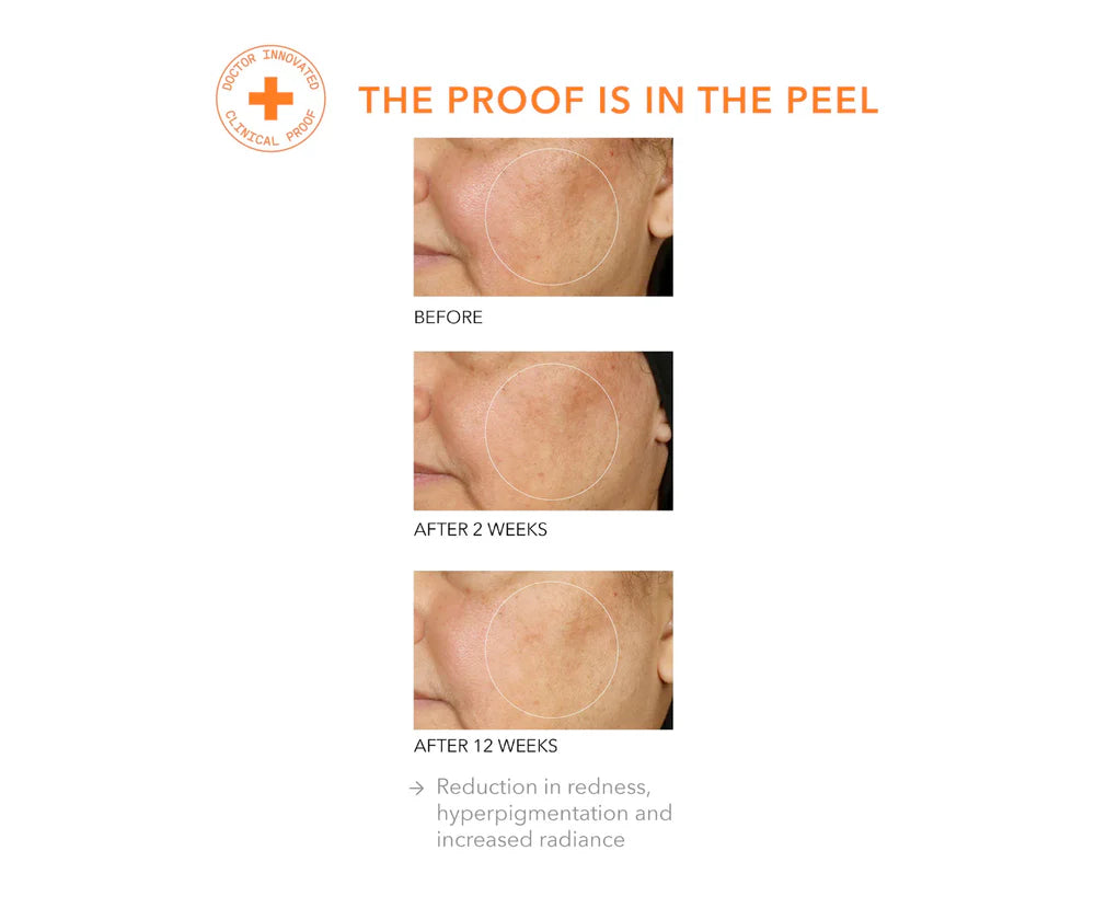 Alpha Beta® Universal Daily Peel 30 stk