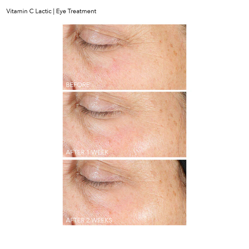 Vitamin C Lactic Firm & Bright Eye Treatment