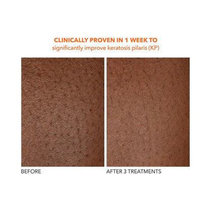 Alpha Beta® Exfoliating Body Treatment 8 stk