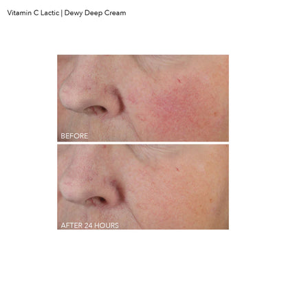 Vitamin C Lactic Dewy Deep Cream