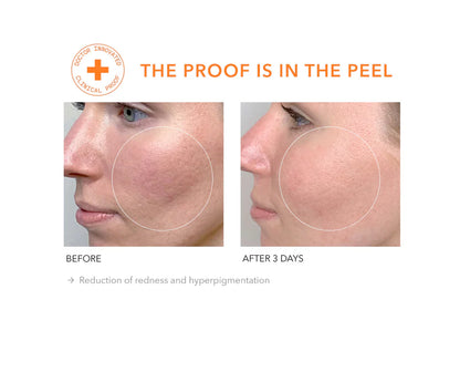 Alpha Beta® Extra Strength Daily Peel 30 stk