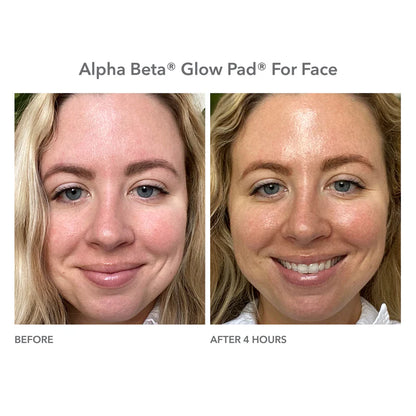 Alpha Beta® Glow Pad™ 20 stk