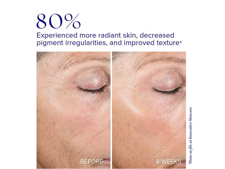 Active Peel System - iS Clinical