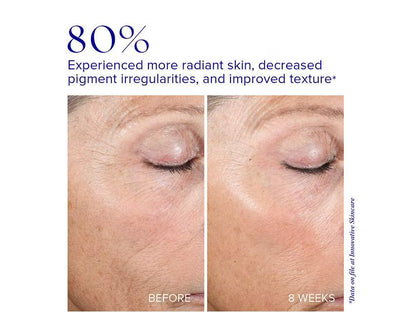 Active Peel System - iS Clinical